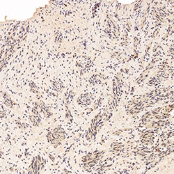 sars-cov-2 gene expression in a human fetus
